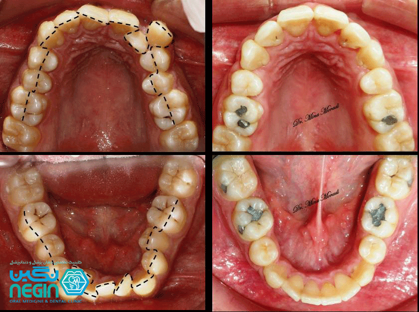 ارتودنسی دندان کلینیک نگین