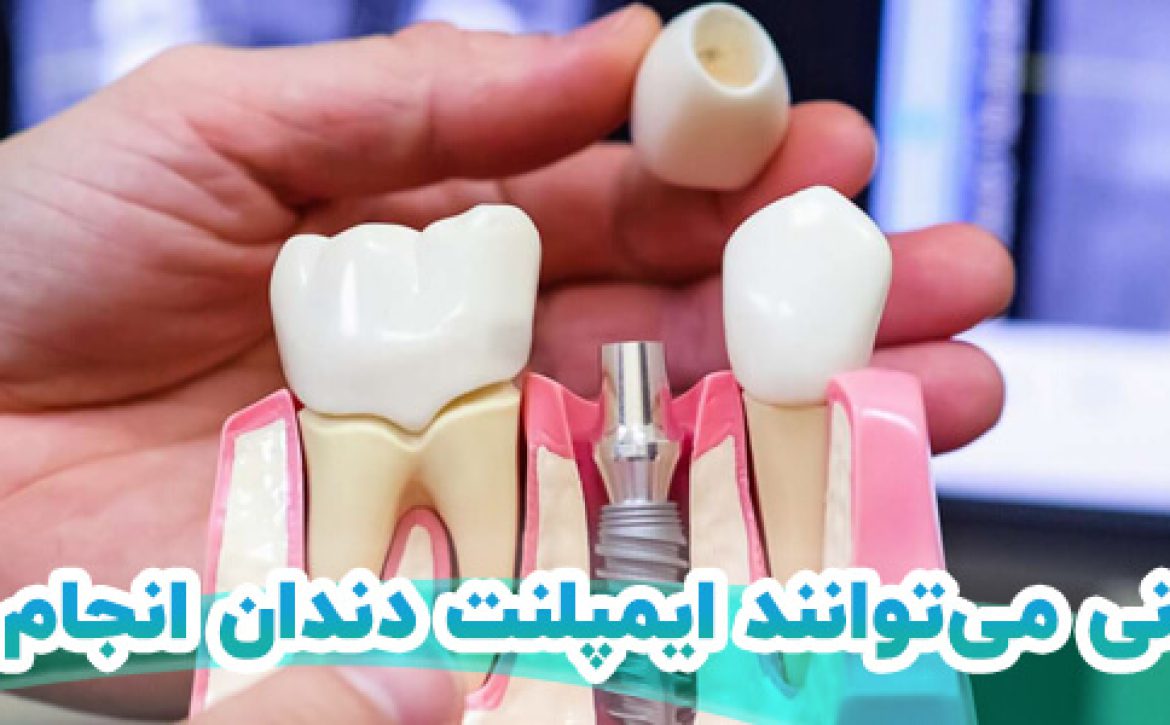 ایمپلنت دندان در شیراز کلینیک نگین 1