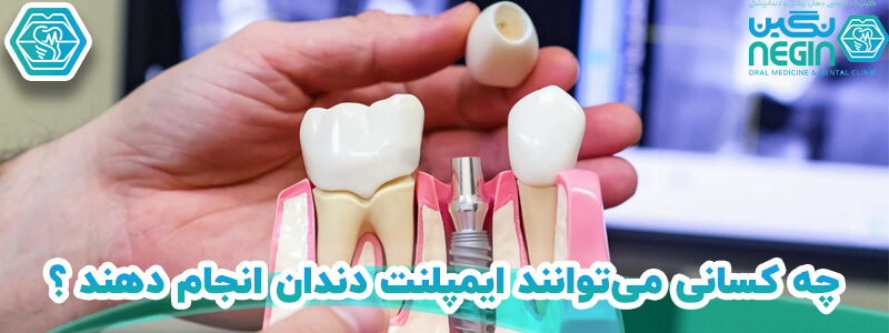 ایمپلنت دندان در شیراز - کلینیک نگین