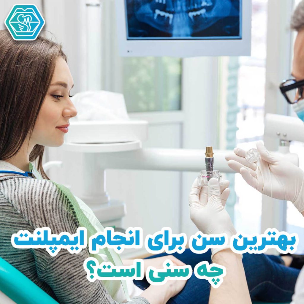 
ایمپلنت دندان در شیراز - کلینیک نگین