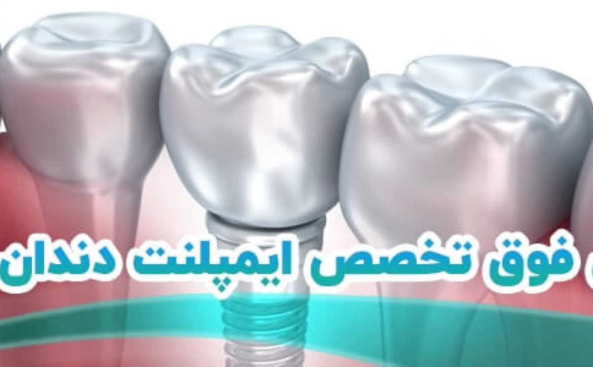 بهترین دندانپزشک فوق تخصص ایمپلنت دندان شیراز