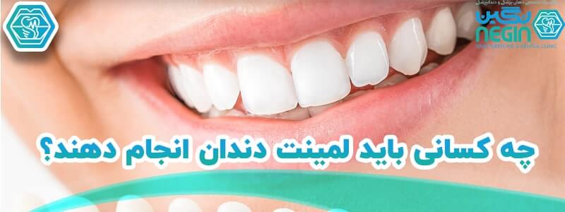 لمینت دندان در شیراز-کلینیک نگین (1)