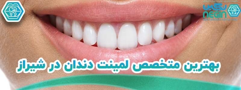 بهترین متخصص لمینت دندان در شیراز