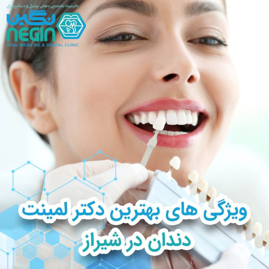 ویژگی های بهترین دکتر لمینت دندان در شیراز