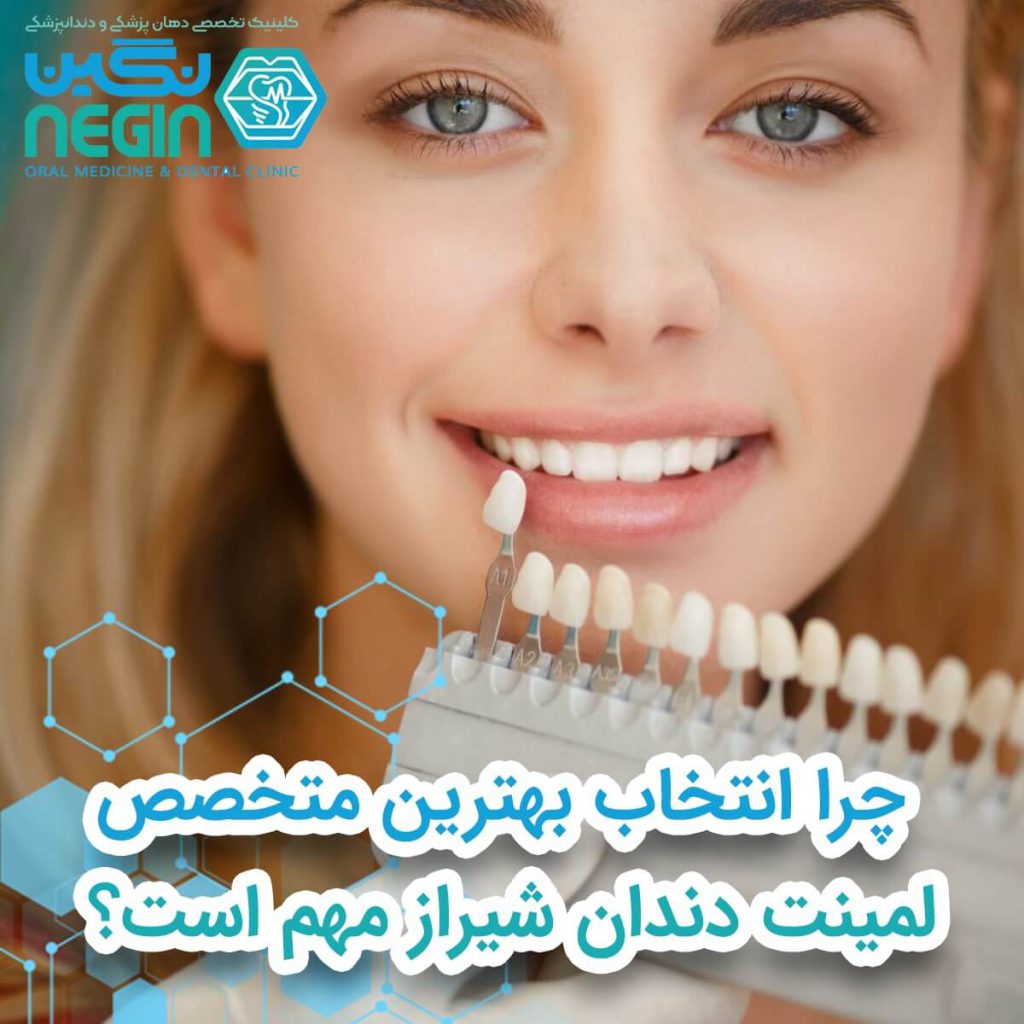 چرا انتخاب بهترین متخصص لمینت دندان شیراز مهم است؟