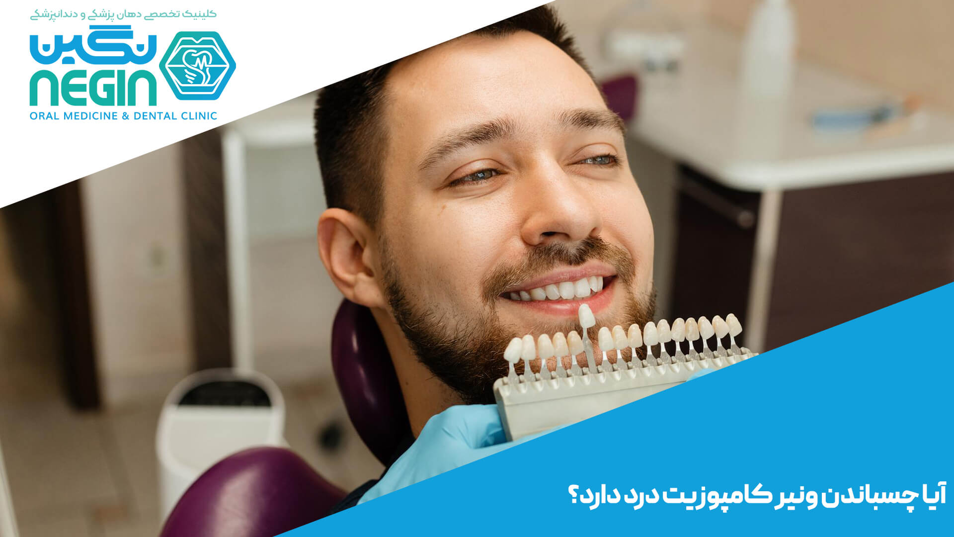 دوام ونیر کامپوزیت و عوامل موثر بر آن- کلینیک دندانپزشکی نگین