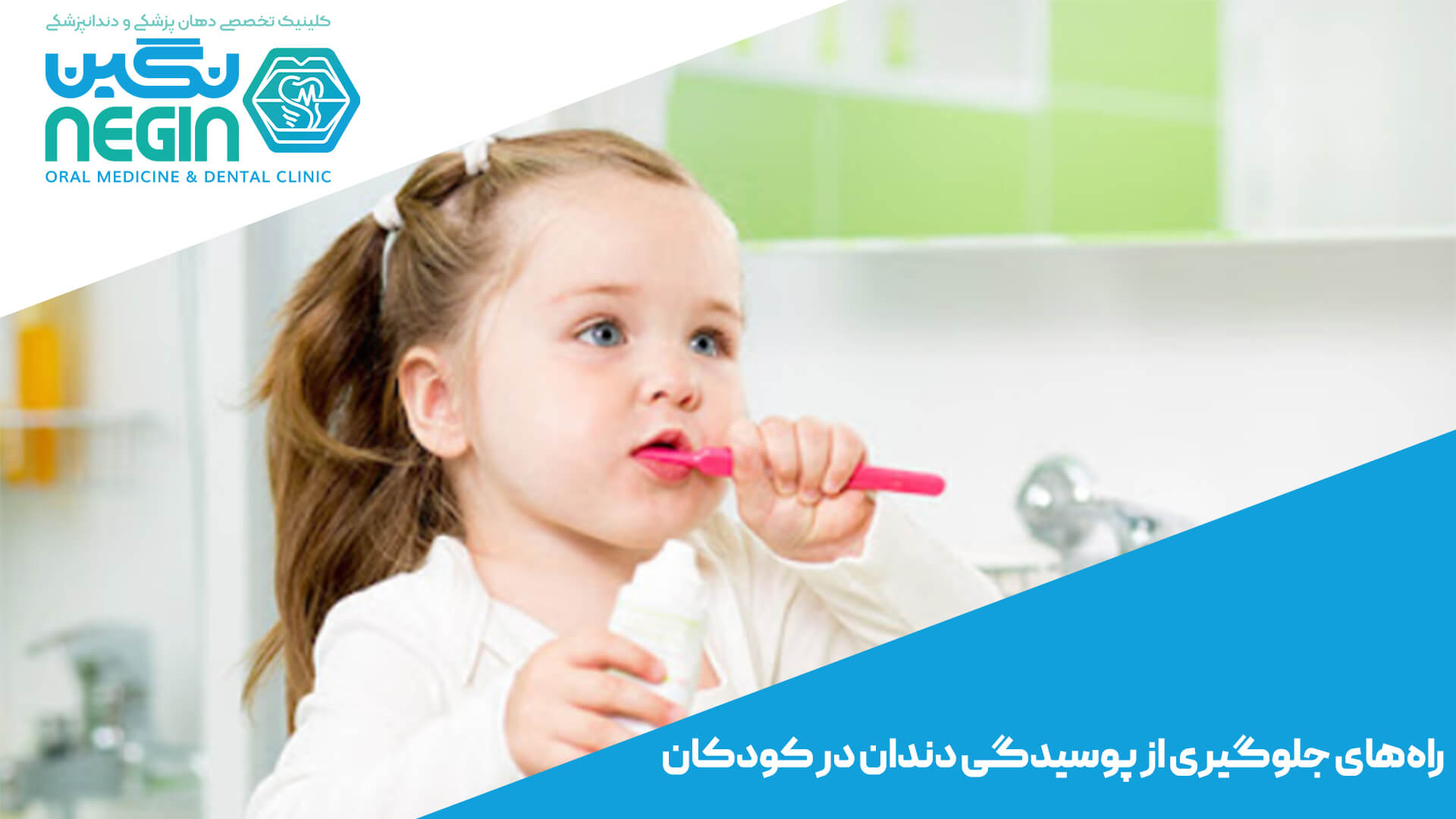 راه‌های جلوگیری از پوسیدگی دندان در کودکان