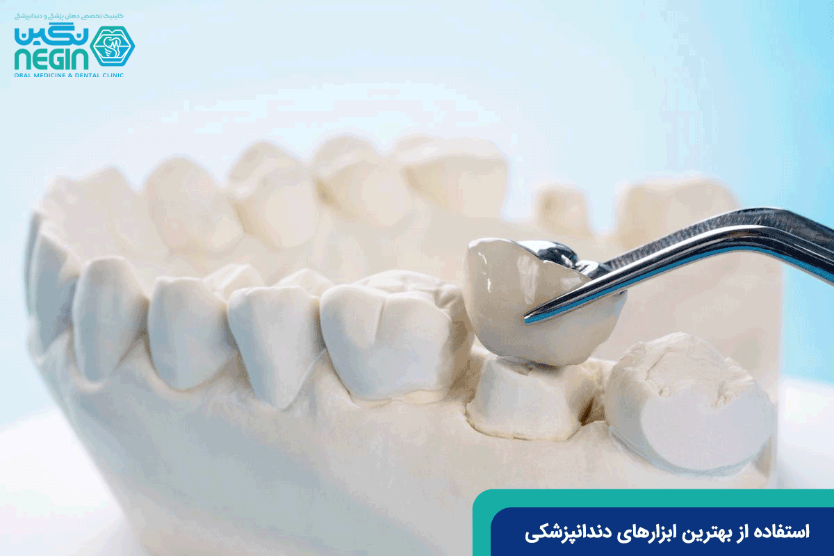استفاده-از-ابزارهای-مناسب-توسط-بهترین-متخصص-روکش-دندان-شیراز