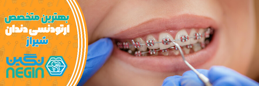 بهترین متخصص ارتودنسی دندان شیراز