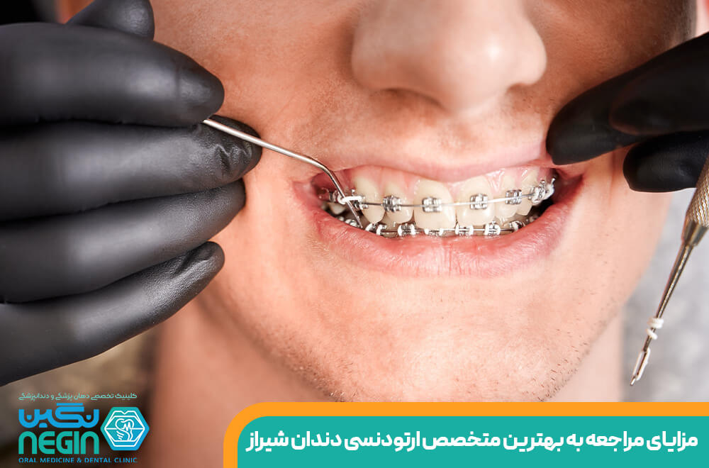 مزایای مراجعه به بهترین متخصص ارتودنسی دندان شیراز