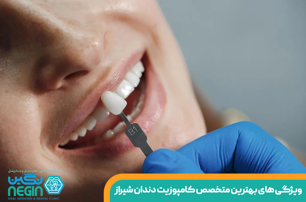 ویژگی های بهترین متخصص کامپوزیت دندان در شیراز