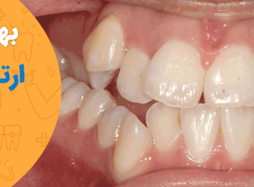 بهترین کلینیک ارتودنسی دندان در شیراز 840x300