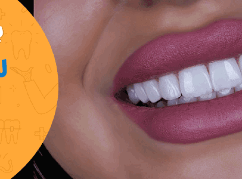 بهترین کلینیک لمینت دندان شیراز 840x300