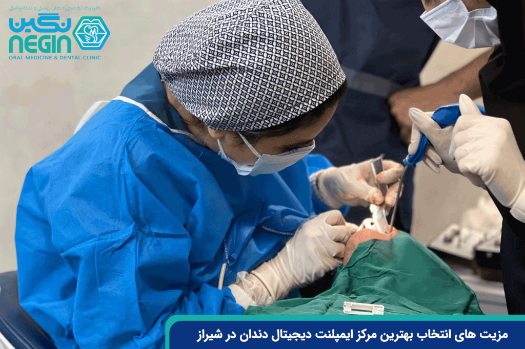 مزیت های انتخاب بهترین مرکز ایمپلنت دیجیتال دندان در شیراز
